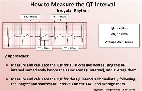  HR heart rate, QT interval the time from the start of the Q wave to the end of the T wave, QTc interval heart rate corrected QT interval, calculated with a correction method described earlier 27 , 28 , QRS interval the time from the onset to the end of the QRS complex