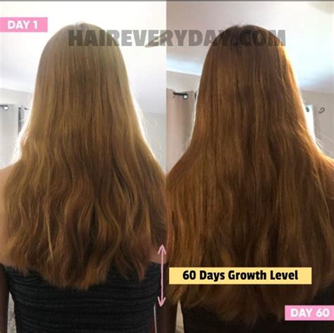  Hair takes approximately 2 weeks to grow from the hair bulb to reach the skin