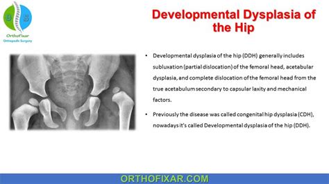  Hip Dysplasia, the most common orthopedic condition in the bullied, is caused by a faulty back leg joint