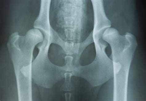  Hip radiographs show most Bulldogs to be dysplastic but few show overt symptoms
