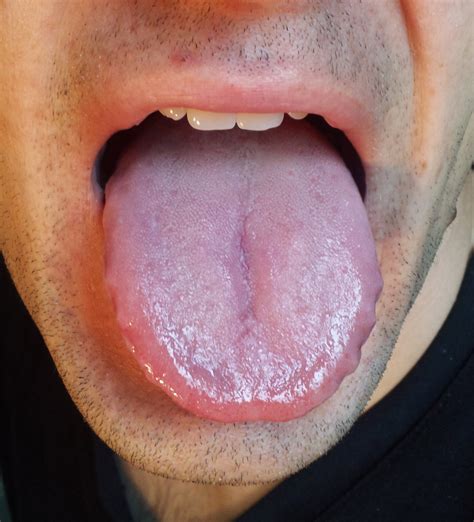  His tongue looks paler than normal and could be swollen