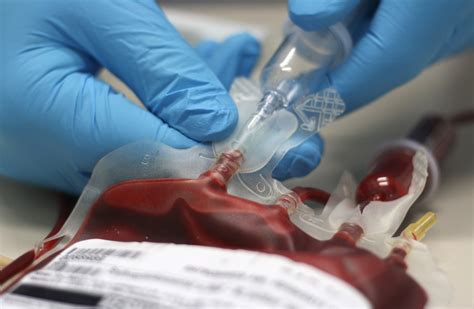 However, it can be managed with treatments that include cauterizing or suturing injuries, transfusions of the von Willebrand factor before surgery, and avoiding certain medications