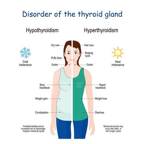  Hypothyroidism : Caused by a deficiency of thyroid hormone, leading to infertility, obesity, mental dullness, and lack of energy