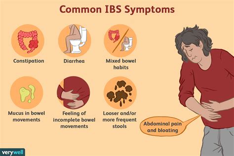  IBS is not caused by inflammation but is caused most commonly by stress and anxiety