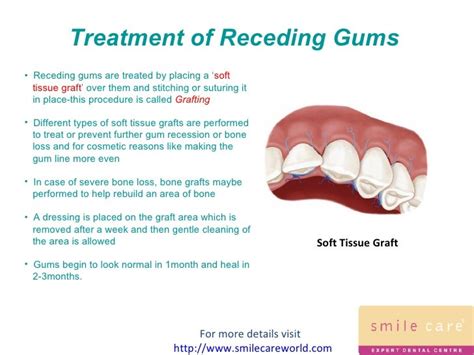  If possible, placing the tincture on the gums could allow it to be absorbed by the capillaries in the gums