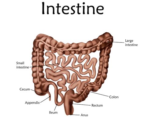  If the intestine cannot be reduced back into the abdomen, it quickly can become painful, necrotic and require emergency surgery where part of the intestine may need to be removed