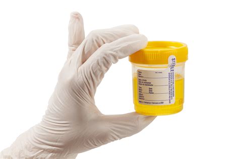  In a urine drug test, a sample of urine is sent to a lab