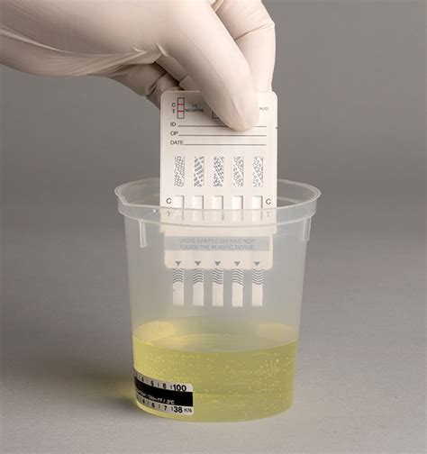  In an IA, the tester adds the drug and drug-specific antibodies to the urine