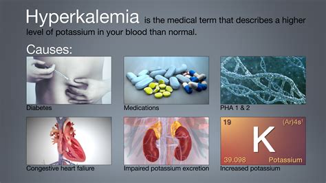  In severe cases, hypernatremia, hyperglycemia, hyperkalemia, azotemia, and acidosis can occur