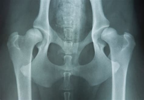  In severe cases of hip dysplasia, dogs may experience decreased mobility, arthritis in their joints , and a degree of lameness generally in their hind end