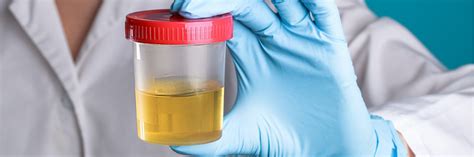  In some cases, it may be more practical to take a blood sample than a urine sample