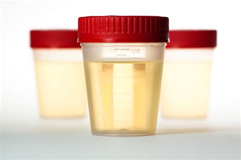  In the event that a urine specimen is considered dilute at the collection site, the test participant is placed on a Dilution Log and asked to produce additional specimens every 15—20 minutes in an effort to flush the excess water out of their system