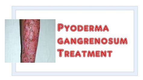  In turn the bacteria and yeast may invade the skin and cause pyodermas
