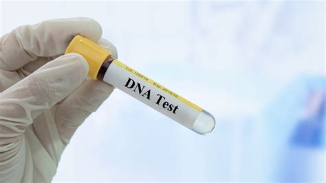  It can be discovered through a DNA test, and at this time, there are no treatments