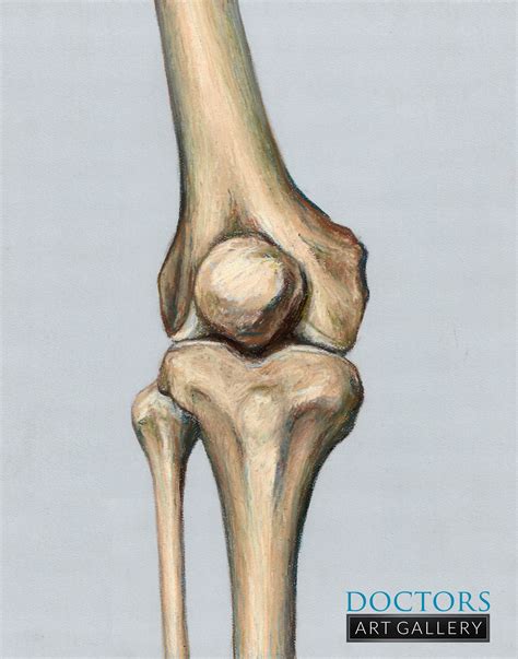  It is caused when the patella, which has three parts — the femur thigh bone , patella knee cap , and tibia calf — is not properly lined up and slips in and out of place luxates