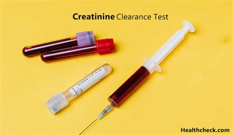  It is more likely that an attempt to dilute a test, for example, will trigger temperature and creatinine tests and possibly additional confirmation tests