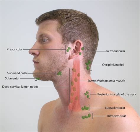  It may be localized to one area like the lymph nodes surrounding the head or be systemic throughout the body
