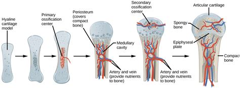  It occurs when abnormal cartilage develops on the end of a bone in their joints