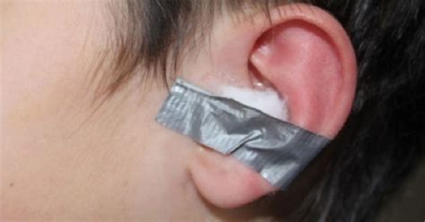  Make sure the ear is kept flat while taping to avoid a wrinkled-looking ear base