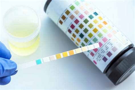  Many at-home urine tests allow you to complete the test after collecting the urine sample