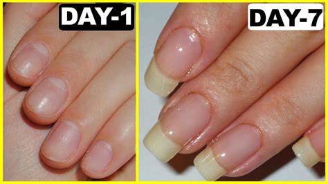  Nail trims once or twice a month keep nails from growing too long and causing issues