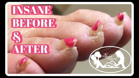  Nail trims once or twice monthly keep them from growing too long and causing issues