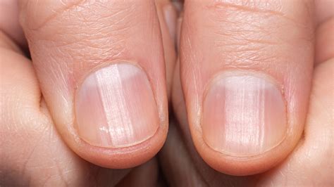  Nails grow quickly and need trimming regularly, say monthly, and ears need to be checked for debris that could cause infection