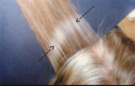  National Institutes of Health Go to source Note: Because it can take up to a week for drug-affected hair to grow above the scalp, hair tests can miss very recent drug use