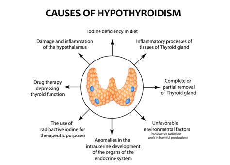  One of the most common causes, however, is hypothyroidism, caused through a malfunction in the canine thyroid gland; this can be treated with an oral hormone replacement medication, such as thyroxine