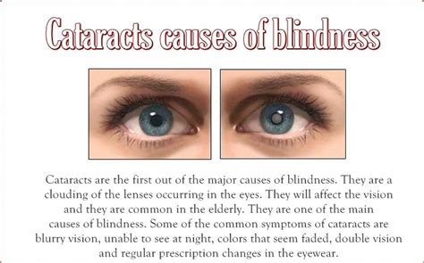  Other issues that are common are cataracts, a degenerative condition that may lead to blindness