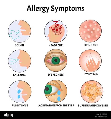  Other symptoms that will appear along with this are reverse sneezing and itching