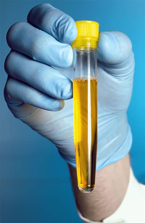  Our labs do rigorous specimen validity testing to test the urine to find out if it has been adulterated or substituted