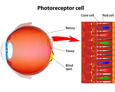  PRA is an eye disorder that eventually causes blindness from the loss of photoreceptors at the back of the eye