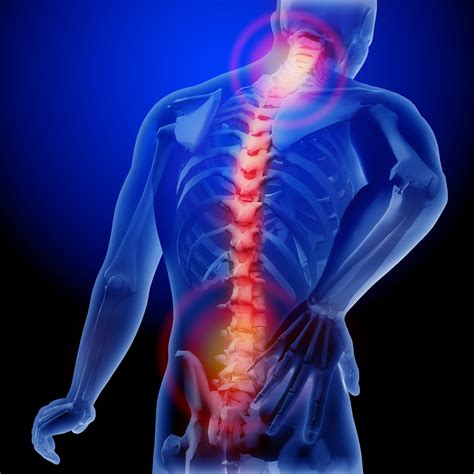  Pain management Lower doses of CBD are generally adequate for neuropathic pain, but higher dosages are often necessary for conditions causing chronic pain and inflammation such as osteoarthritis OA , says Dr