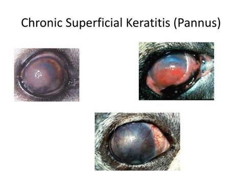  Pannus Pannus, or superficial keratitis, is an immune-mediated painful eye condition that can cause blindness if not managed properly