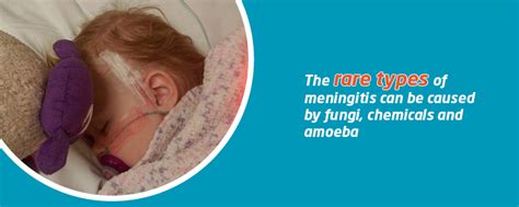  Parasitic meningitis is extremely rare but can be fatal