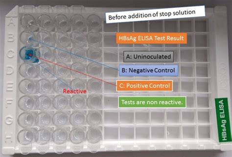  Regardless of which assay kit is used, test results should be interpreted by qualified personnel and positive results verified so that there is a very limited possibility of a false-positive result