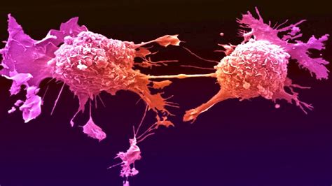  Research proves full spectrum shrinks tumors