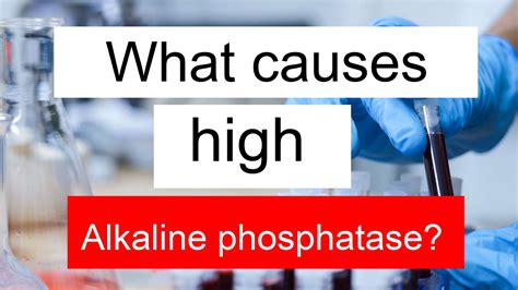  Scientific data on the topic is conflicting as some research shows it causes increased levels of alkaline phosphatase while others demonstrate it inhibits the liver enzymes