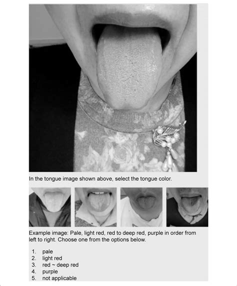  Screen of tongue diagnosis test using elearning system. Candidates