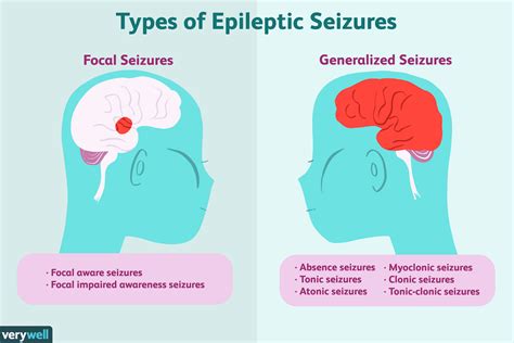  Secondary Seizures Secondary seizures are those that have a clearly diagnosed brain abnormality as the cause of the seizure