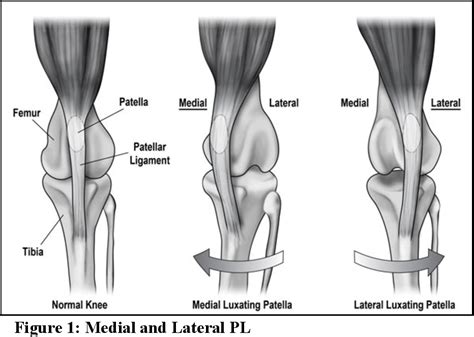  Severe grades of patellar luxation may require surgical repair