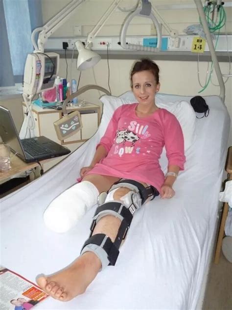  She had an accident with her family where her leg was caught in some furniture » Read more »