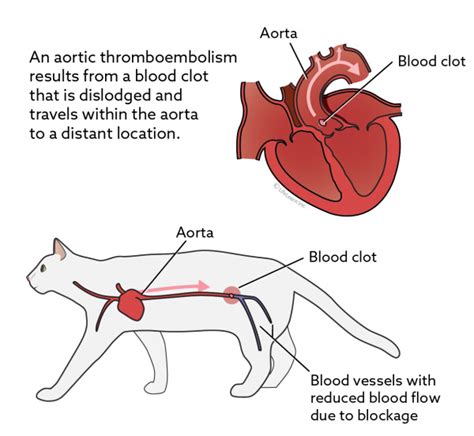 Sleeper said, but the prognosis worsens once cats develop CHF and arterial thromboembolism
