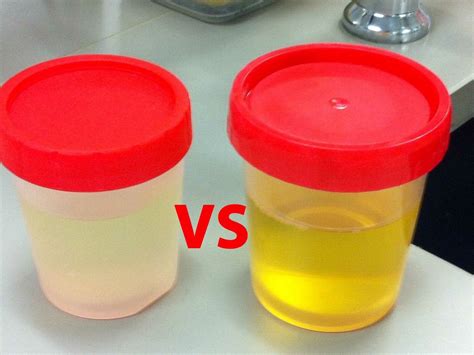  So your options are using synthetic or real clean urine