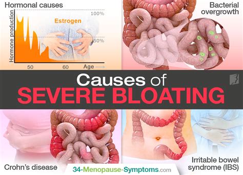  Some reasons for bloat can be fatal if left untreated