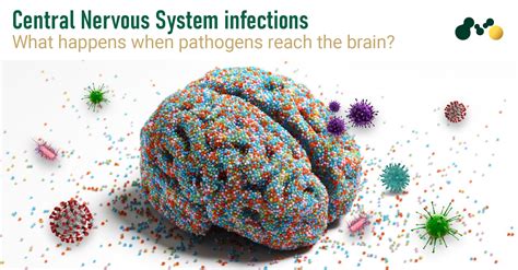  Specific infections affecting the nervous system sometimes become the root cause of seizures