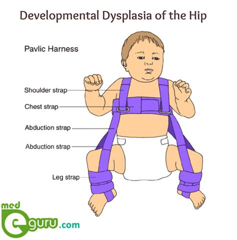  Symptoms of Hip Dysplasia include: Bunny hopping, decreased activity or difficulty standing up