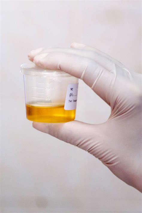  The biggest challenge in using substitute urine is keeping the urine at the correct temperature
