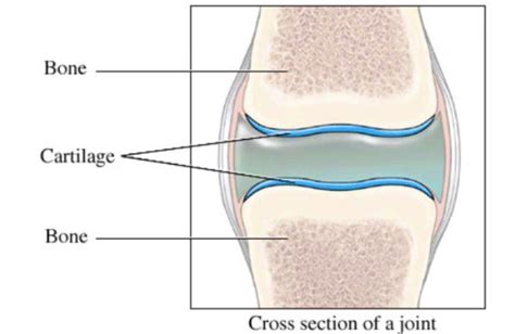  The cartilage in joints breaks down, and bones rub together without cushion